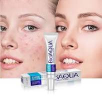 BIOAQUA Pure Skin Acne Rejuvenation & Cream - 30g