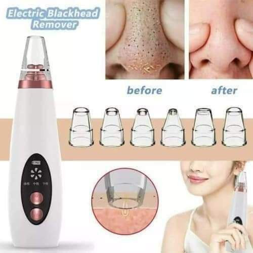 CkeyiN Facial Cleaning 5 Tips Blackhead Remover Electric Vacuum Suction Blackhead Acne Extractor Pores Deeply Cleaning Tool Multifunctional Skin Care Beauty Device MR278W-B
