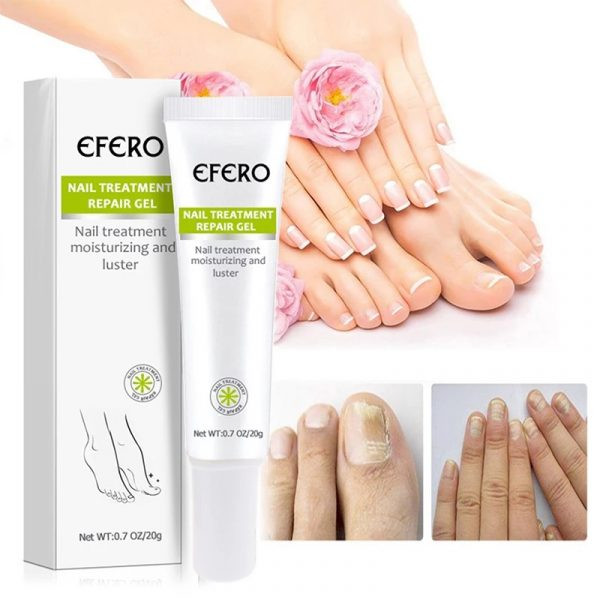 Efero Nail Repair Treatment Gel Fungus Cream-20gm